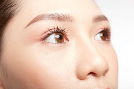 Lấy mỡ mí trên cải thiện sụp mí: Giải pháp cho đôi mắt trẻ trung 4