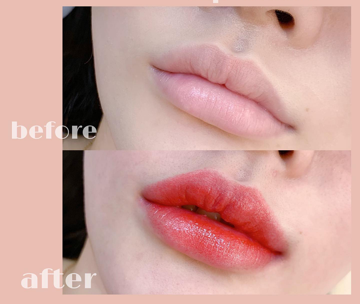 Phun môi pha lê - Bí quyết sở hữu đôi môi căng bóng rạng rỡ 5 Ai nên chọn phun môi pha lê?