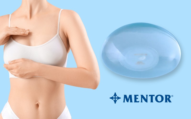 Nâng ngực nội soi túi Mentor là gì?