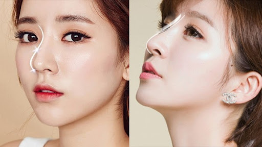 Nâng Mũi Baby Nose Nhẹ Nhàng: Bí Quyết Tạo Dáng Mũi Tự Nhiên, Thanh Thoát 5 Lợi ích sức khỏe và thẩm mỹ từ nâng mũi baby nose nhẹ nhàng