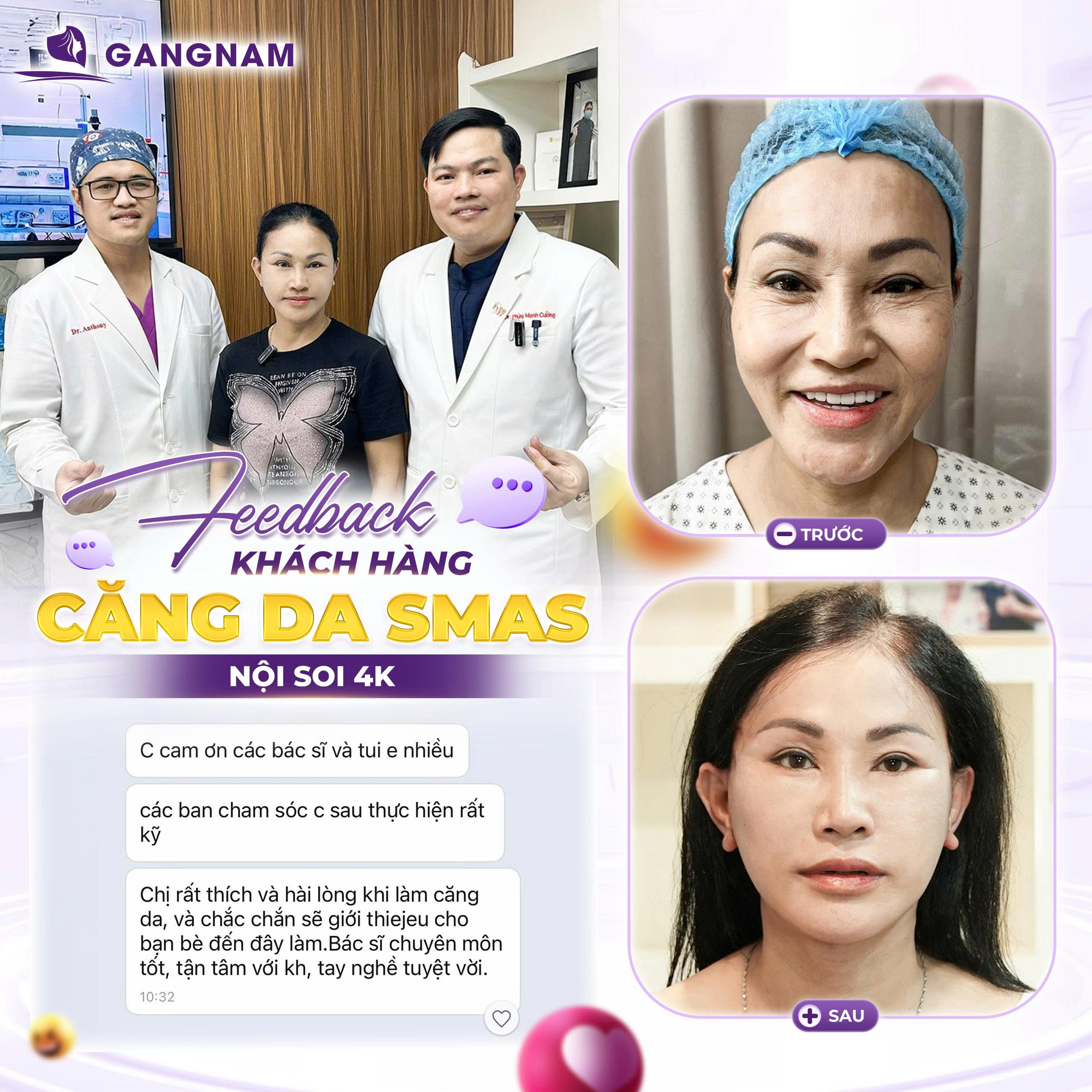 Căng da mặt SMAS 4K Thẩm mỹ Gangnam – Nơi gửi gắm nhan sắc và sự tự tin