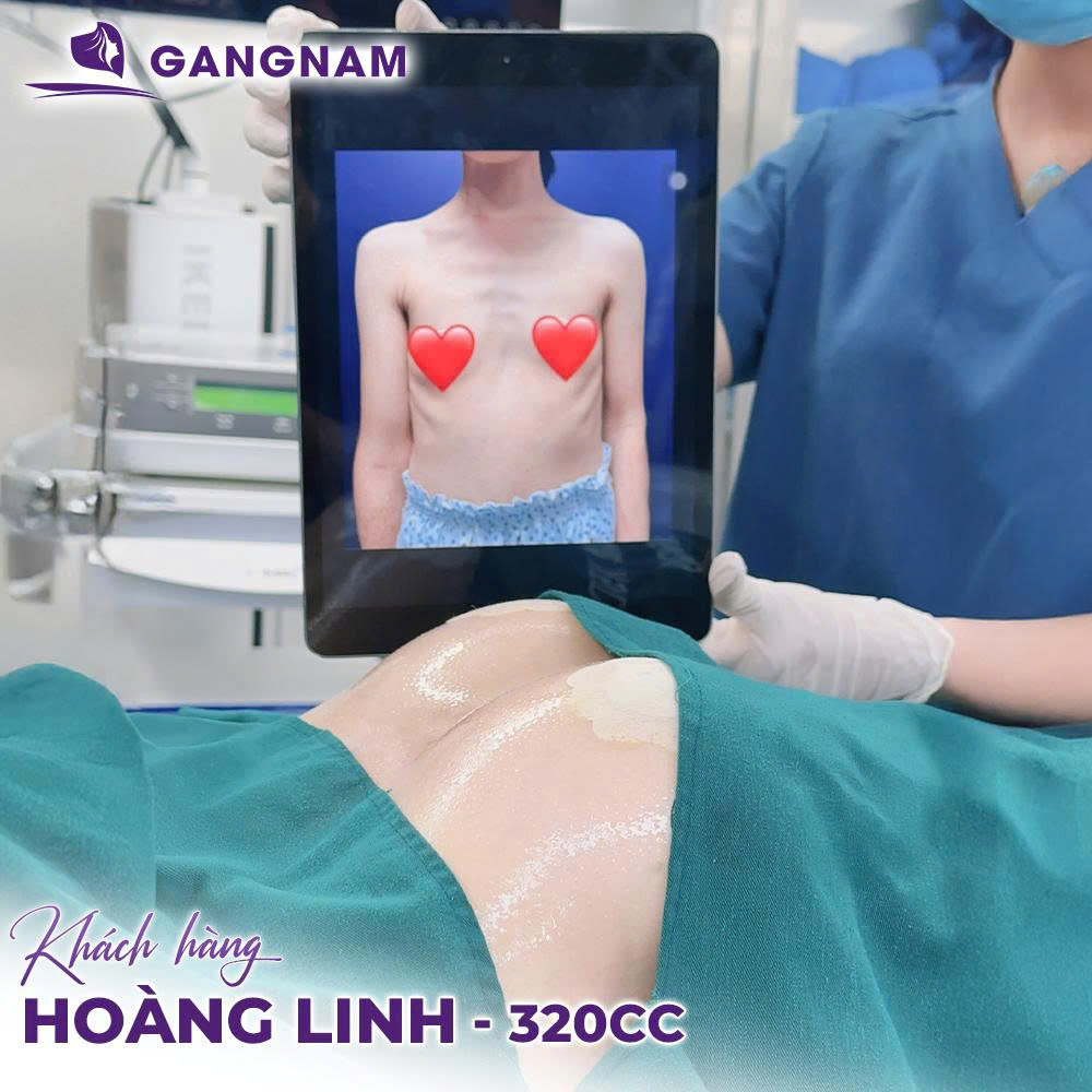 Đối tượng phù hợp với nâng ngực Nano chip thông minh