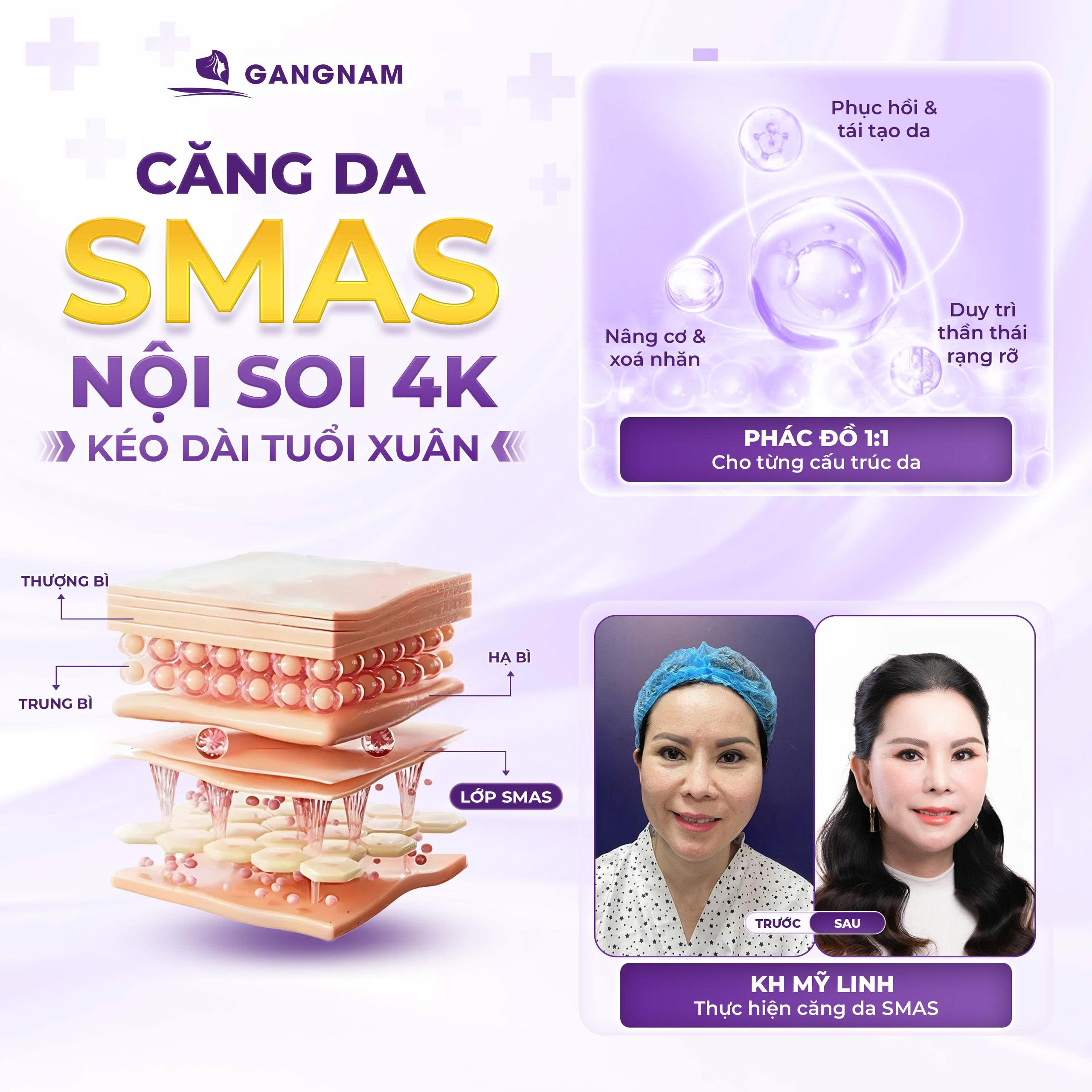 Căng da mặt nội soi 4K tại Thẩm mỹ Gang Nam