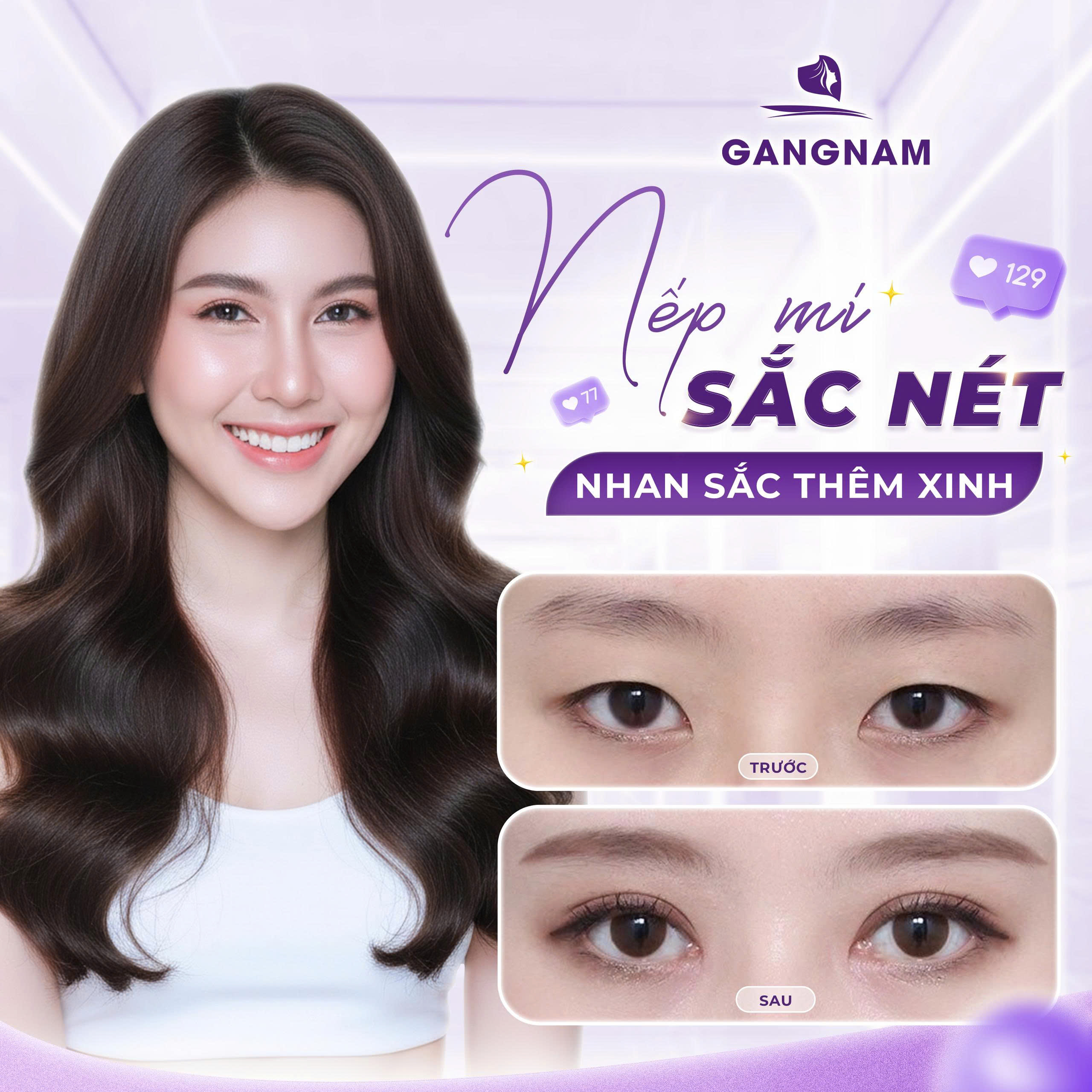 Lợi ích vượt trội của thẩm mỹ mắt 2 mí