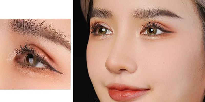 Cắt mí công nghệ 4in1 – Bí quyết sở hữu đôi mắt trẻ trung tự nhiên 4 Cắt mí công nghệ 4in1 là gì?