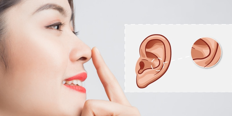 Nâng Mũi Cấu Trúc Sụn Vành Tai Là Gì?