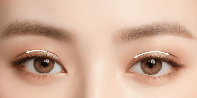 Bấm mí Perfect Line: Bí quyết sở hữu đôi mắt hai mí tự nhiên, cuốn hút 4 Bấm mí Perfect Line là gì?