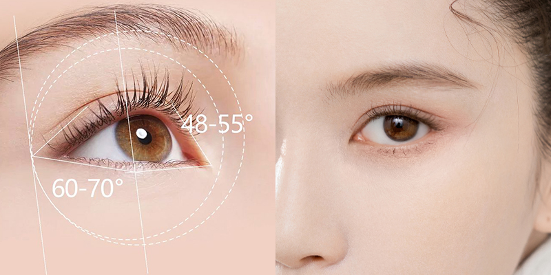 Mở góc mắt trong: Bí quyết sở hữu đôi mắt to tròn, cân đối tự nhiên 4 Mở góc mắt trong là gì?
