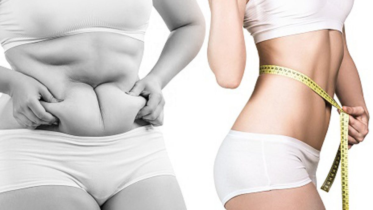 Hút mỡ eo tạo dáng S-line: Bí quyết sở hữu vòng eo thon gọn quyến rũ 5 Ai phù hợp với hút mỡ eo tạo dáng S-line?