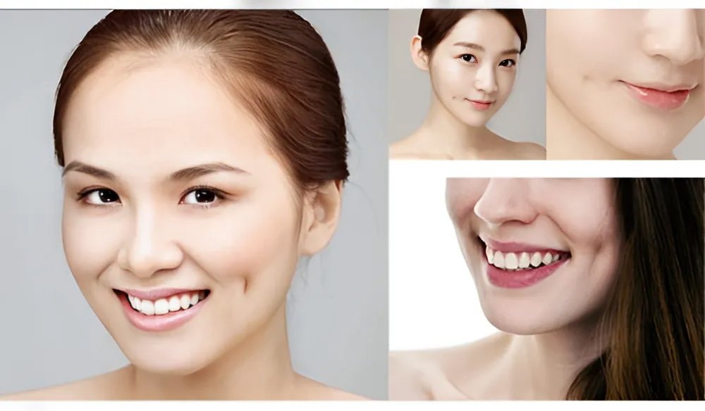 Tạo má lúm đồng tiền bằng chỉ: Bí quyết sở hữu nụ cười duyên dáng tự nhiên 4 Tạo má lúm đồng tiền bằng chỉ là gì?