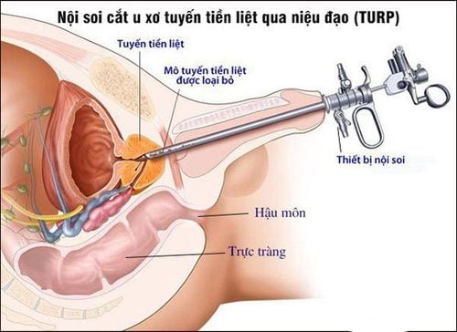 Cắt môi lớn đẹp tự nhiên: Bí quyết tái tạo vùng kín hài hòa và tự tin 5 Cắt môi lớn đẹp tự nhiên: Bí quyết tái tạo vùng kín hài hòa và tự tin 2