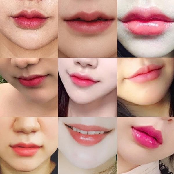 Các dáng môi phổ biến khi tạo hình môi tự nhiên bằng filler