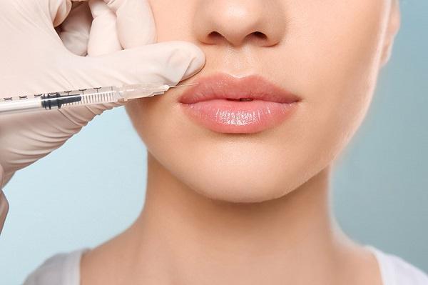 Tiêm filler môi không phẫu thuật: Bí quyết sở hữu đôi môi căng mọng tự nhiên 4 Tiêm filler môi không phẫu thuật là gì?