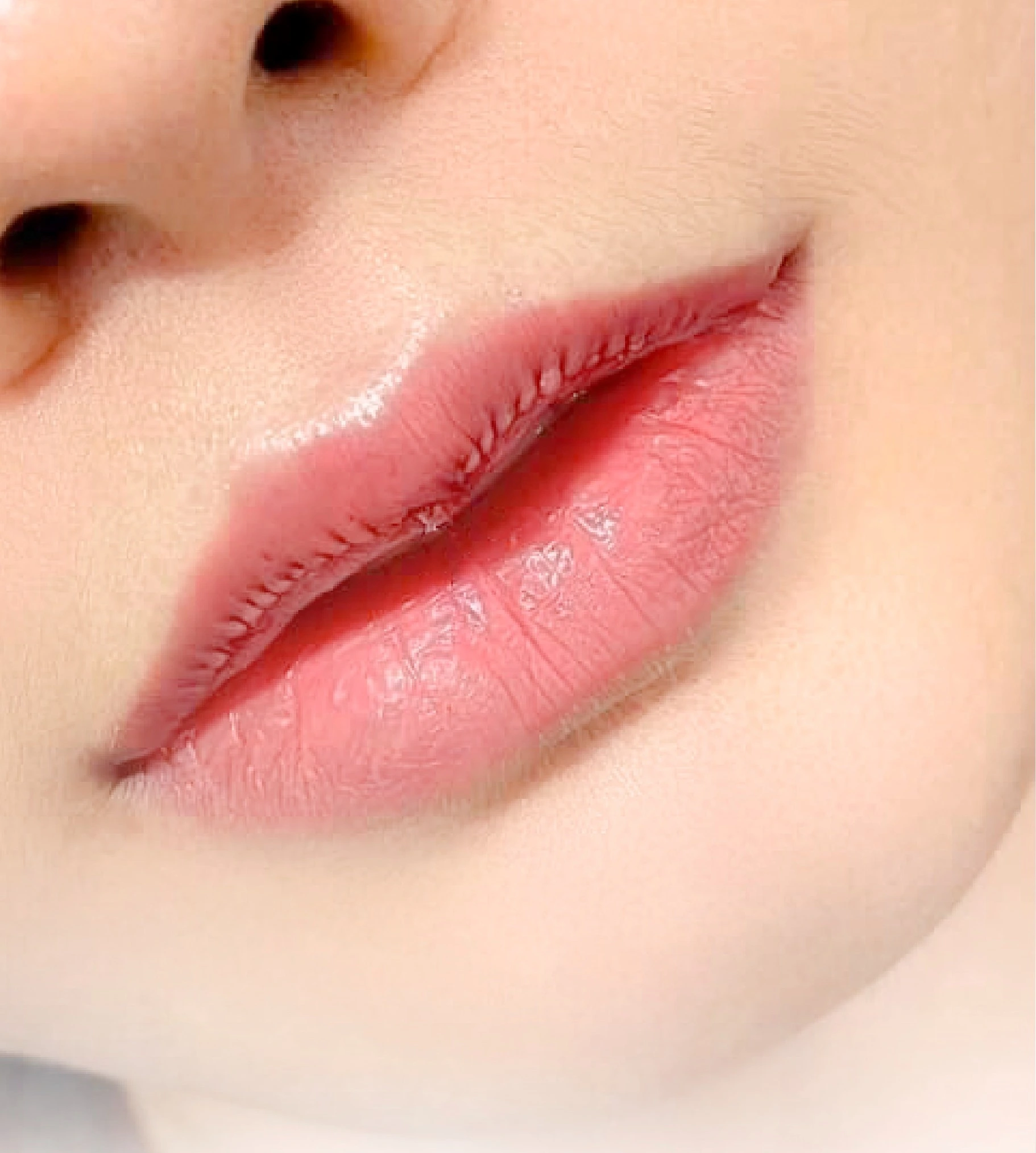 Thu mỏng môi trên: Bí quyết sở hữu đôi môi thanh thoát và quyến rũ 4 Lý do nên chọn thu mỏng môi trên