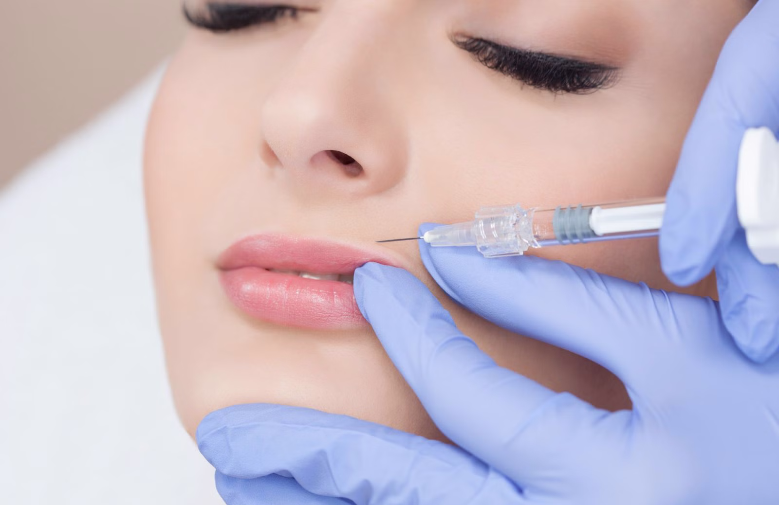 Làm môi căng mọng bằng filler: Bí quyết sở hữu đôi môi quyến rũ tự nhiên 5 Chăm sóc sau khi làm môi căng mọng bằng filler để duy trì kết quả lâu dài