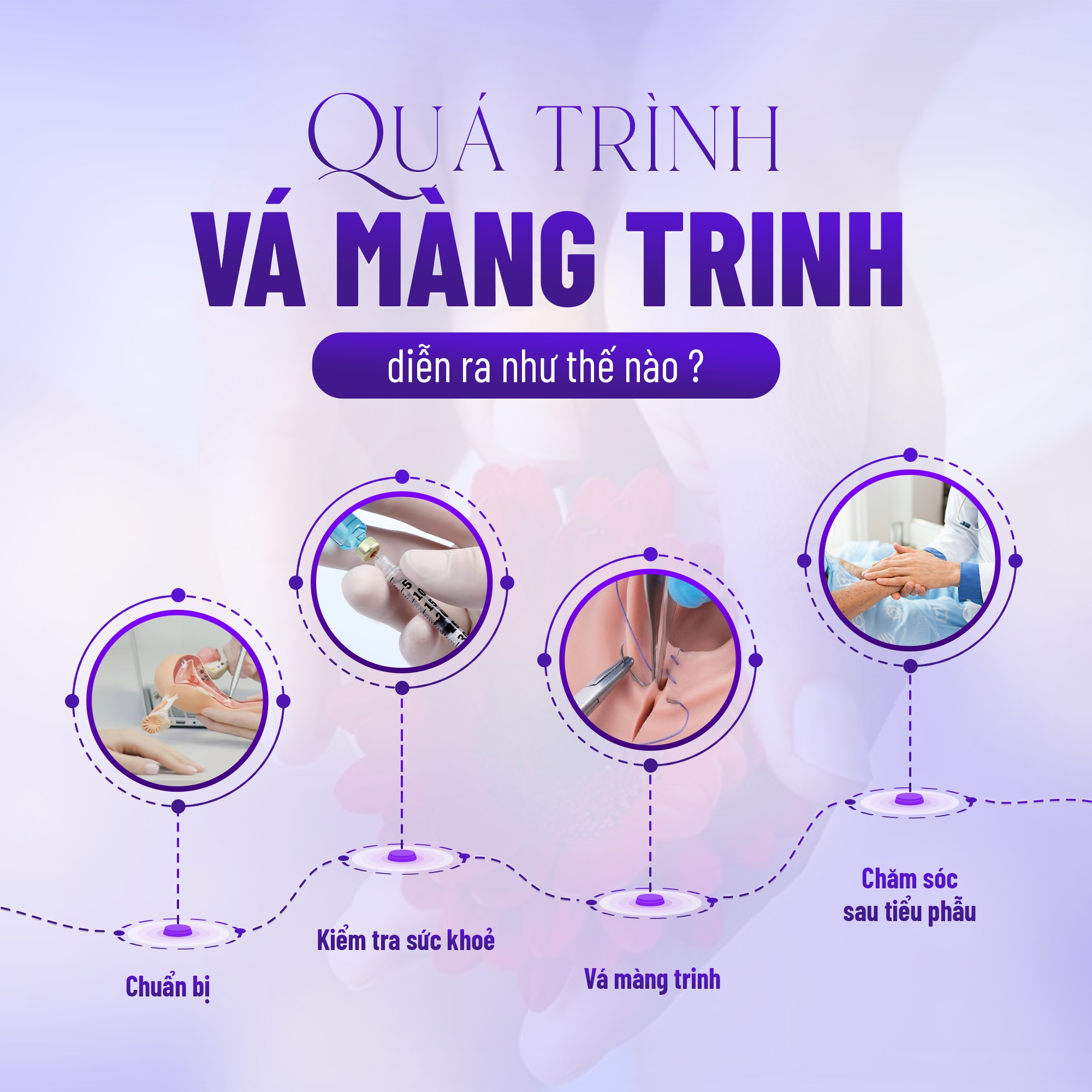 Khâu màng trinh – Giải pháp thẩm mỹ vùng kín mang ý nghĩa tâm lý và sức khỏe 5 Quy trình thực hiện khâu màng trinh an toàn