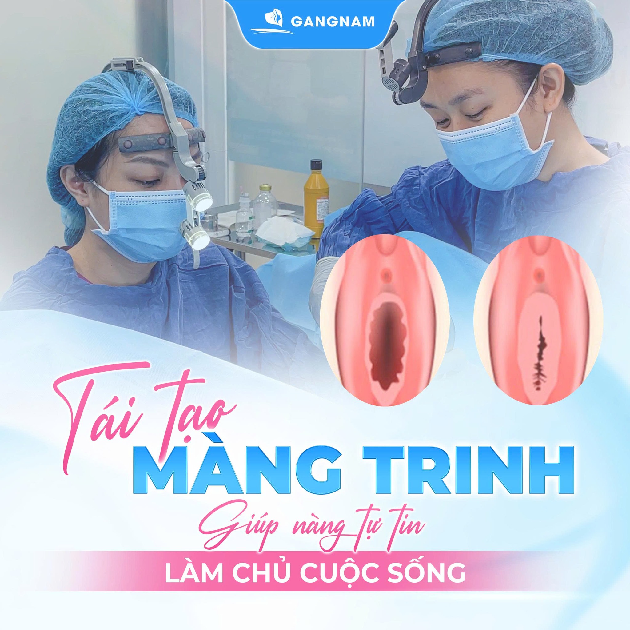 Khâu màng trinh – Giải pháp thẩm mỹ vùng kín mang ý nghĩa tâm lý và sức khỏe 6 Thẩm mỹ Gangnam – Điểm đến cho vẻ đẹp chuẩn Hàn hiện đại