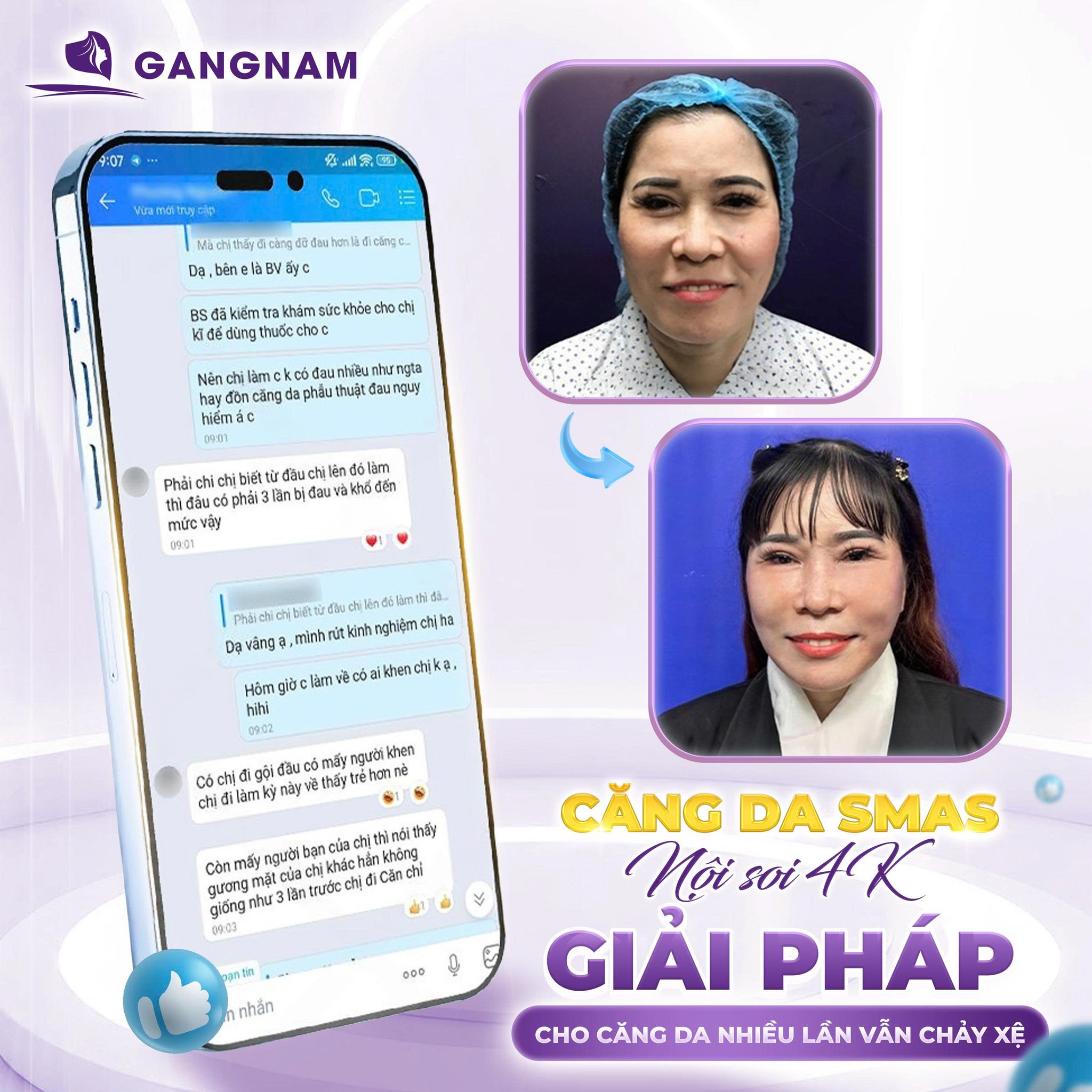 Căng da SMAS: Giải pháp trẻ hóa toàn diện cho làn da chảy xệ 5 Đối tượng phù hợp với căng da SMAS