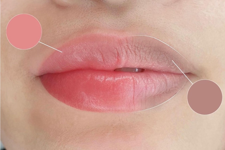 Trẻ hóa môi công nghệ cao: Bí quyết sở hữu đôi môi căng mọng tự nhiên 5 Đối tượng phù hợp thực hiện trẻ hóa môi
