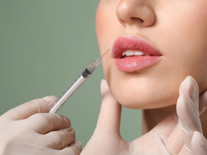 Tiêm filler tạo hình môi: Bí quyết sở hữu đôi môi hoàn hảo tự nhiên 4 Tiêm filler tạo hình môi là gì và cơ chế hoạt động như thế nào?