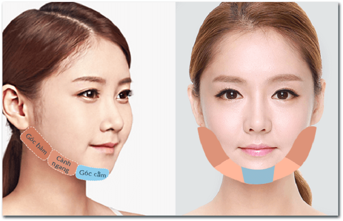 Gọt hàm thẩm mỹ V-line – Bí quyết sở hữu khuôn mặt trái xoan chuẩn Hàn Quốc 4 Gọt hàm thẩm mỹ V-line là gì