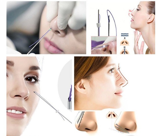 Nâng mũi chỉ collagen: Giải pháp thẩm mỹ hiện đại cho dáng mũi thanh tú tự nhiên 4 Cơ chế hoạt động của nâng mũi chỉ collagen