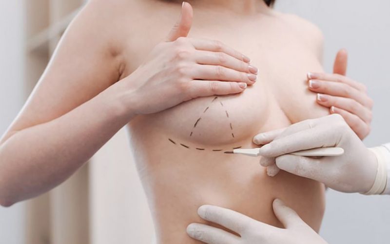 Nâng ngực công nghệ 4K: Bí quyết sở hữu vòng 1 hoàn hảo và an toàn 4 Nâng ngực công nghệ 4K hoạt động như thế nào?