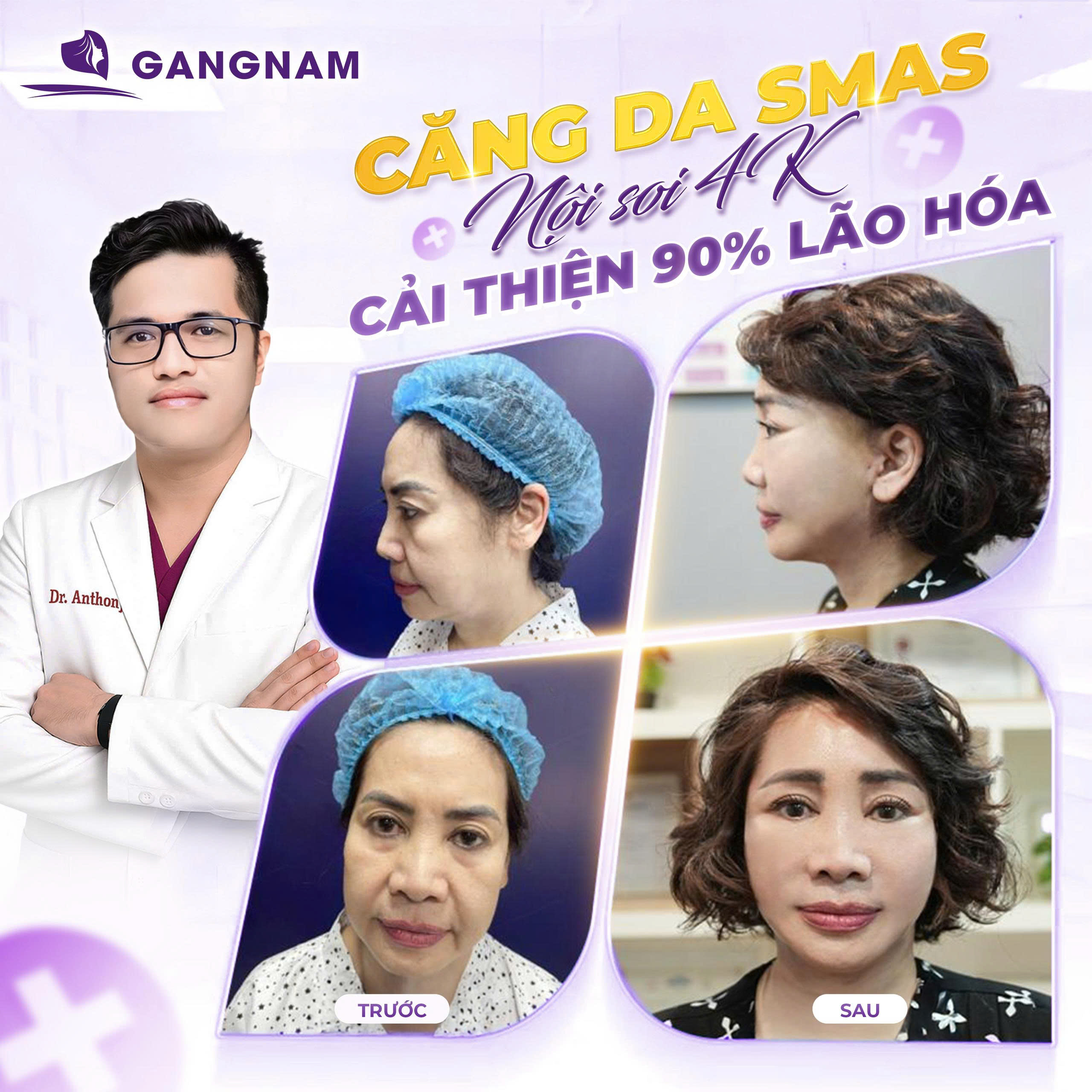 Căng Da Mặt Nội Soi 4K – Giải Pháp Trẻ Hóa Đỉnh Cao Cho Khuôn Mặt Á Đông