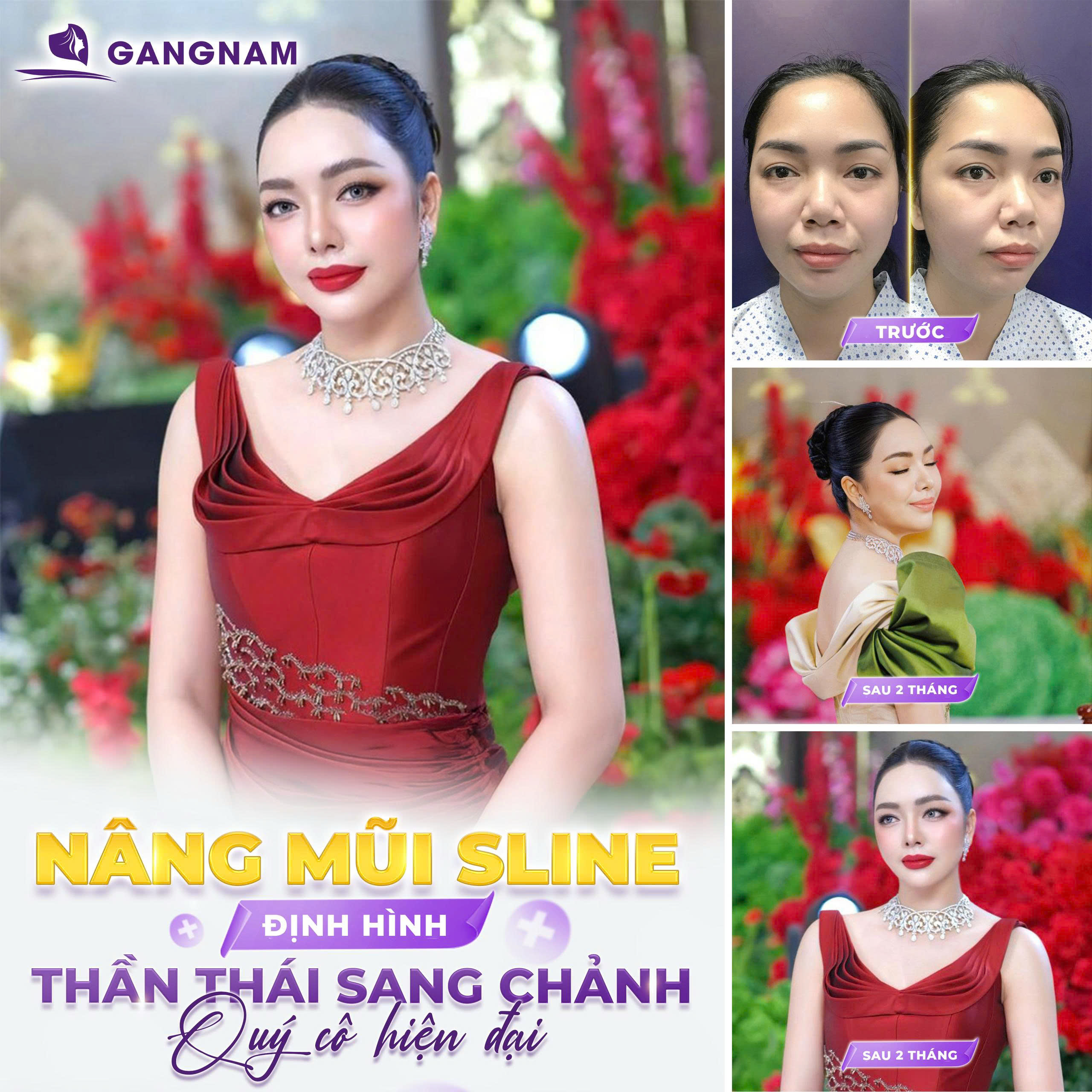 Dáng Mũi S Line Chuẩn Hàn – Hoàn Thiện Vẻ Đẹp Thanh Tú