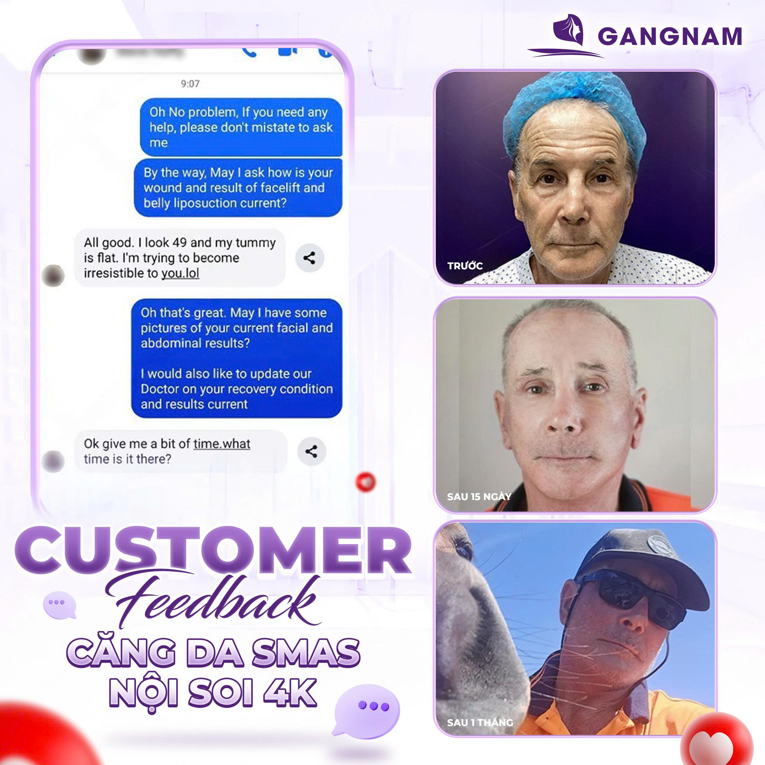 Công Nghệ Căng Da Mặt Nội Soi 4K – Giải Pháp Trẻ Hóa Vượt Trội 2