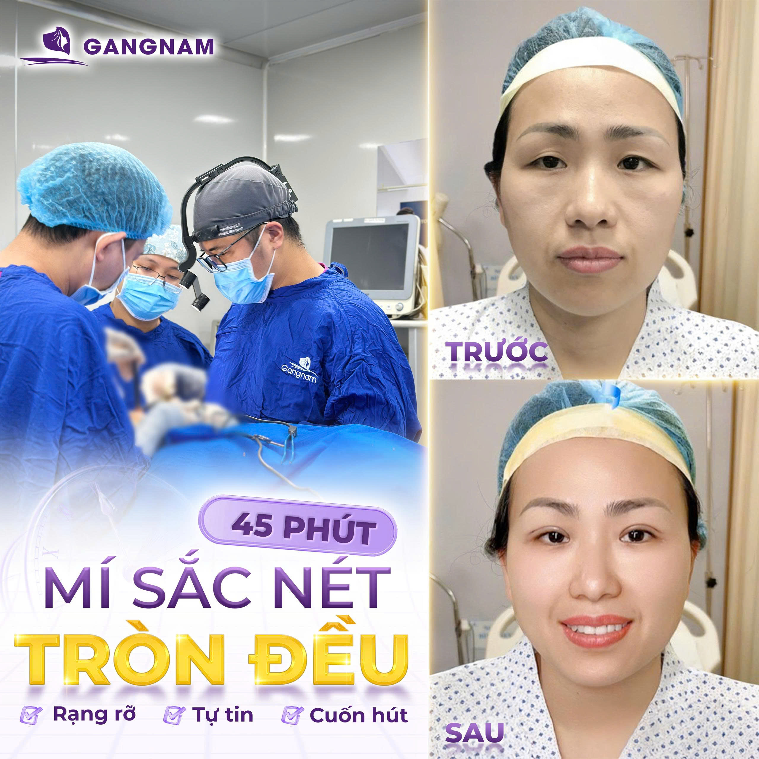 Thẩm mỹ mắt 2 mí: Bí quyết sở hữu đôi mắt to tròn cuốn hút 5 Công nghệ hiện đại hỗ trợ thẩm mỹ mắt 2 mí