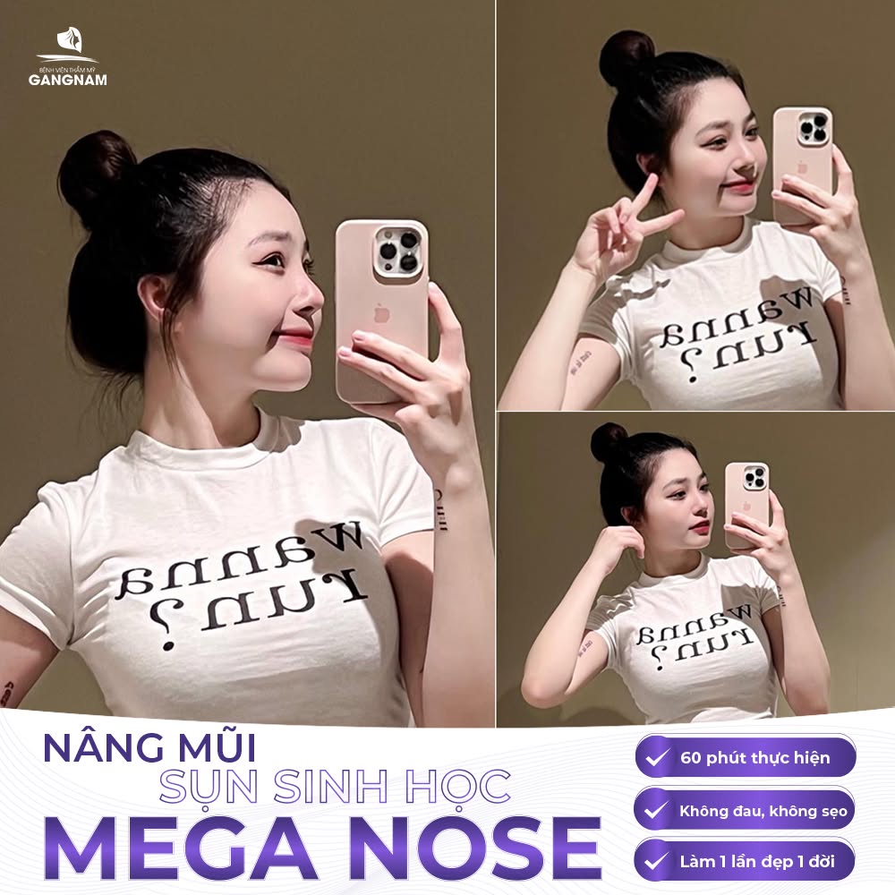 Nâng mũi nội soi Mega Nose – Giải pháp thẩm mỹ mũi an toàn và tự nhiên 6 Nâng Mũi Nội Soi Mega Nose – Chuẩn An Toàn, Đẹp Tự Nhiên Tại Thẩm Mỹ Gangnam