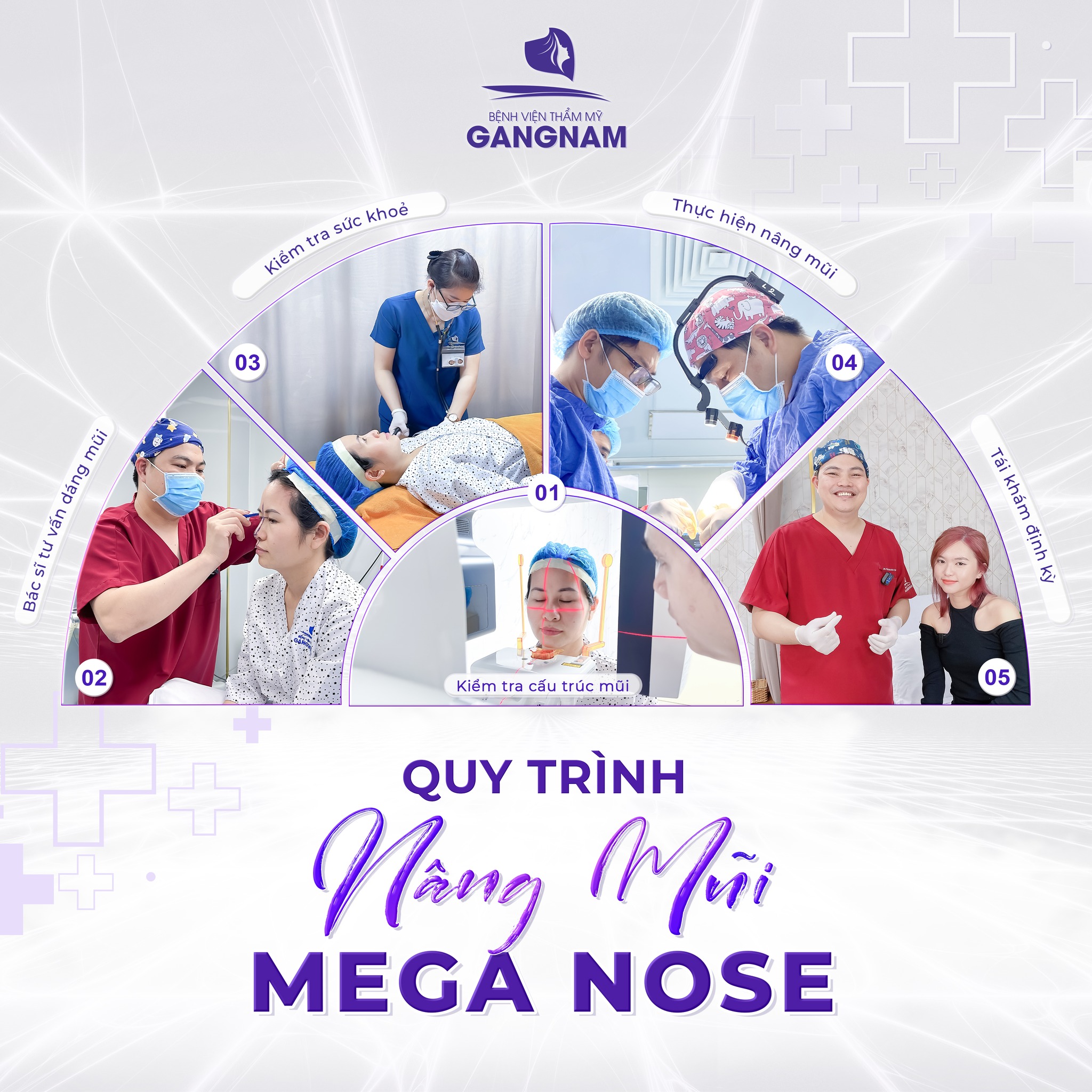 Nâng mũi nội soi Mega Nose – Giải pháp thẩm mỹ mũi an toàn và tự nhiên 5 Quy trình thực hiện nâng mũi nội soi Mega Nose chi tiết