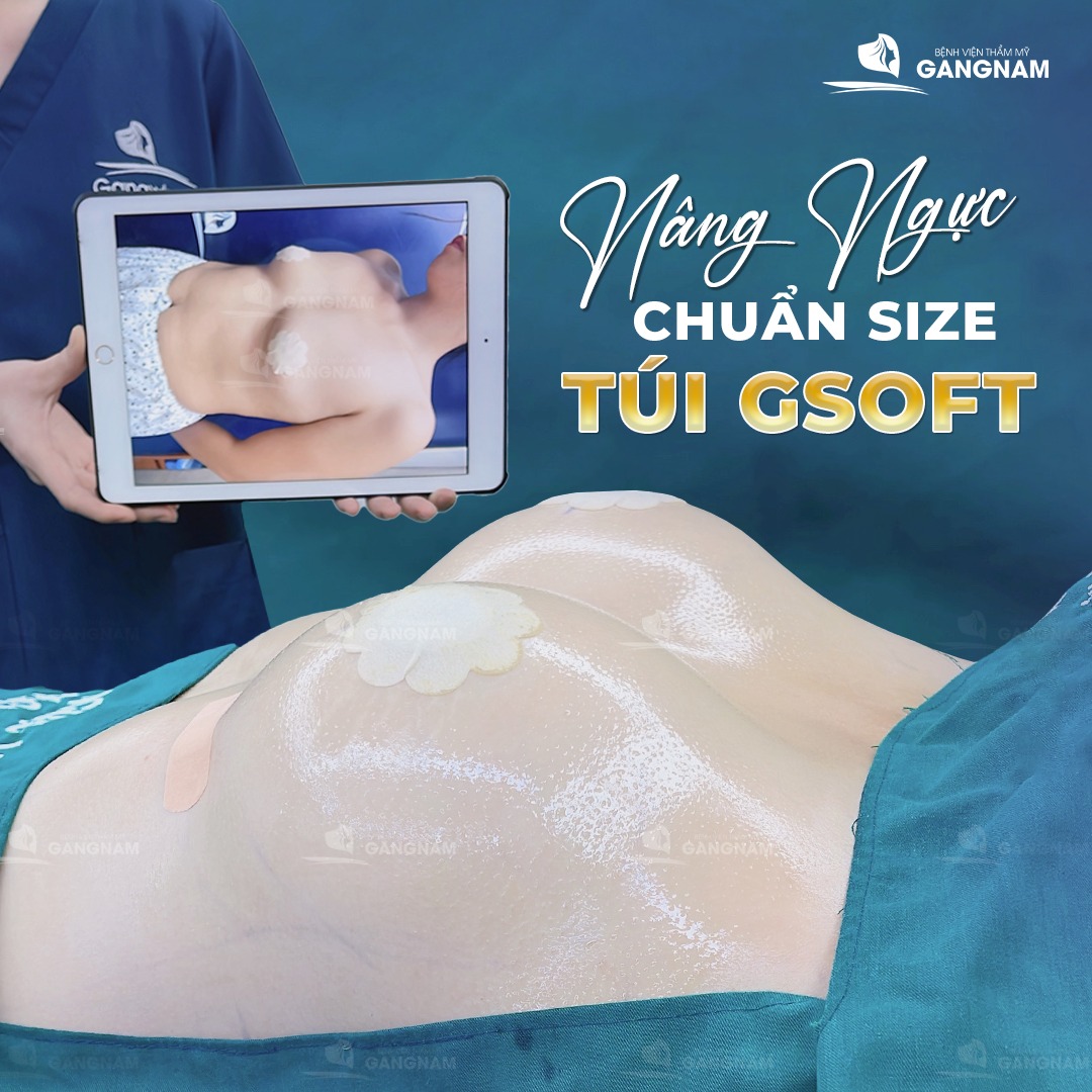 Nâng ngực nội soi túi GSoft – Giải pháp hoàn hảo cho vòng 1 tự nhiên 4 Nâng ngực nội soi túi GSoft là gì?
