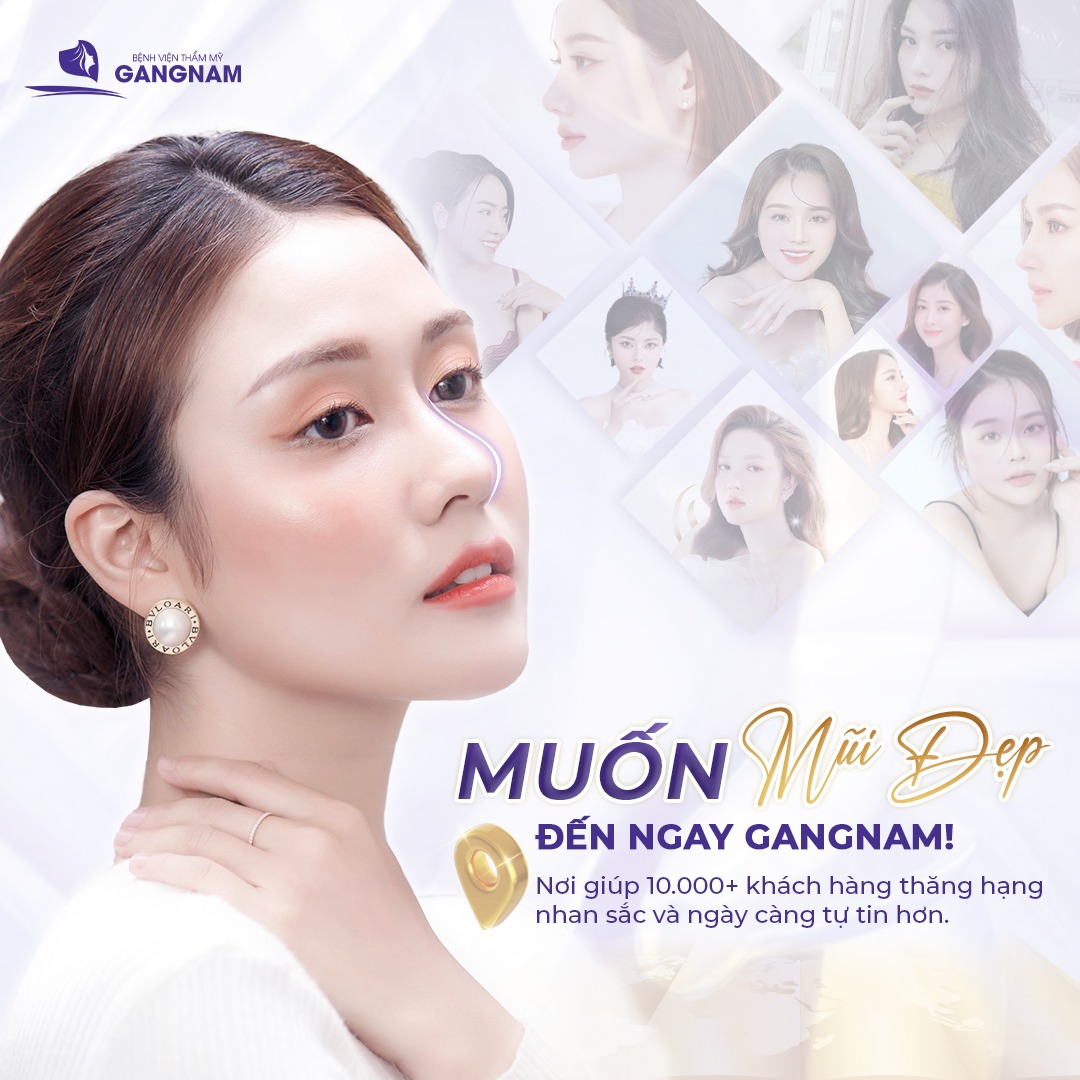 Nâng mũi cấu trúc dáng S-line – Giải pháp tạo hình mũi mềm mại, tự nhiên 5 Nâng mũi cấu trúc dáng S-line – Giải pháp tạo hình mũi mềm mại, tự nhiên 2