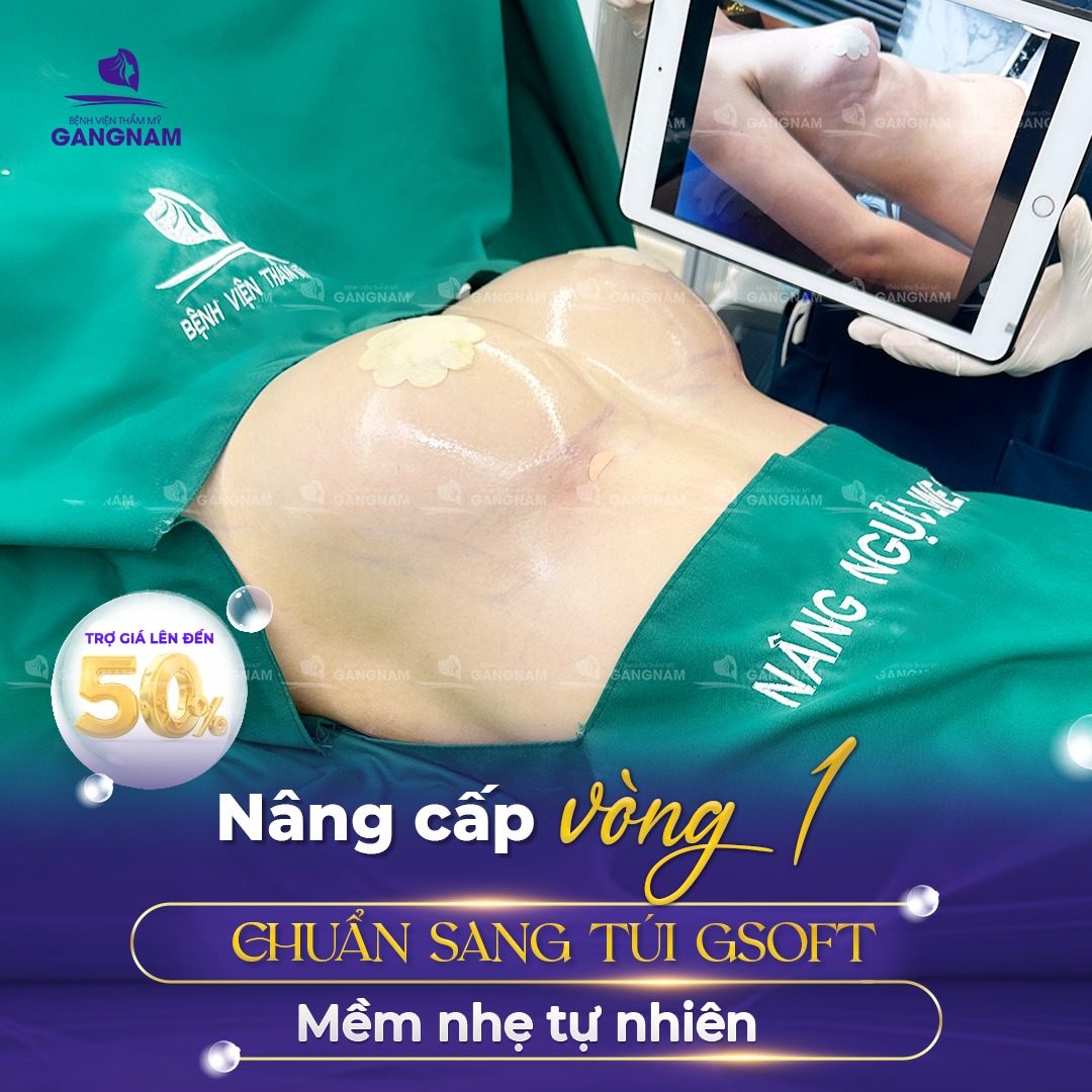 Nâng ngực nội soi túi GSoft – Giải pháp hoàn hảo cho vòng 1 tự nhiên 5 Quy trình nâng ngực nội soi túi GSoft chuẩn y khoa