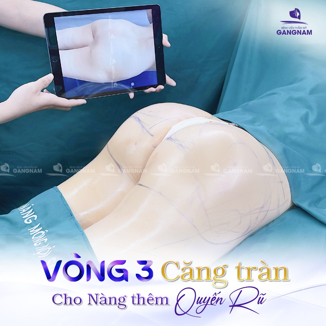 Nâng vòng 3 túi độn – Giải pháp hoàn hảo cho vòng ba căng tròn, tự nhiên 5 Nâng vòng 3 túi độn – Giải pháp hoàn hảo cho vòng ba căng tròn, tự nhiên 2