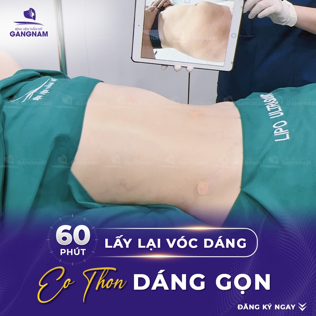 Hút mỡ bụng Lipo tạo hình vòng eo: Quy trình, ưu điểm và chăm sóc sau thực hiện 5 Hút mỡ bụng Lipo tạo hình vòng eo: Quy trình, ưu điểm và chăm sóc sau thực hiện 2