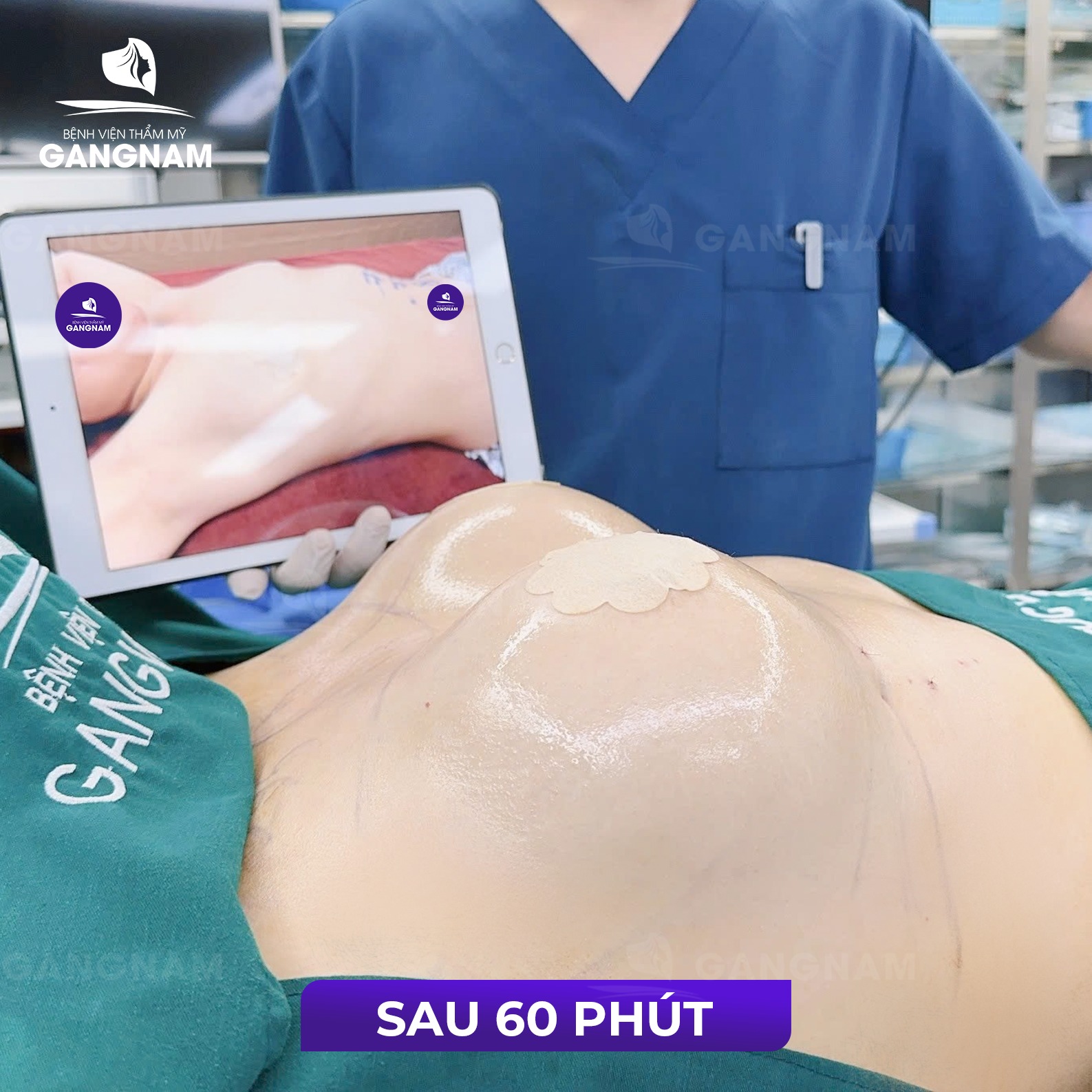 Nâng ngực 4K nội soi: Công nghệ hiện đại cho vòng 1 hoàn hảo và an toàn 5 Đối tượng phù hợp với nâng ngực 4K nội soi