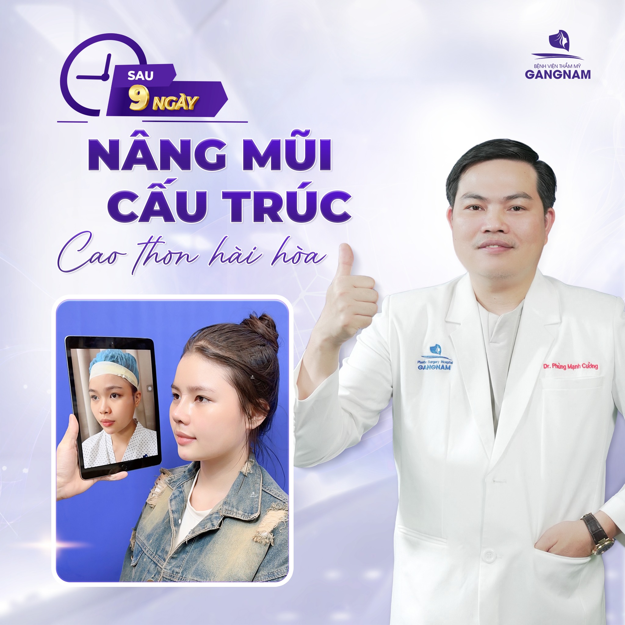 Nâng mũi cấu trúc nội soi: Phương pháp thẩm mỹ mũi tiên tiến 4 Nâng mũi cấu trúc nội soi là gì?
