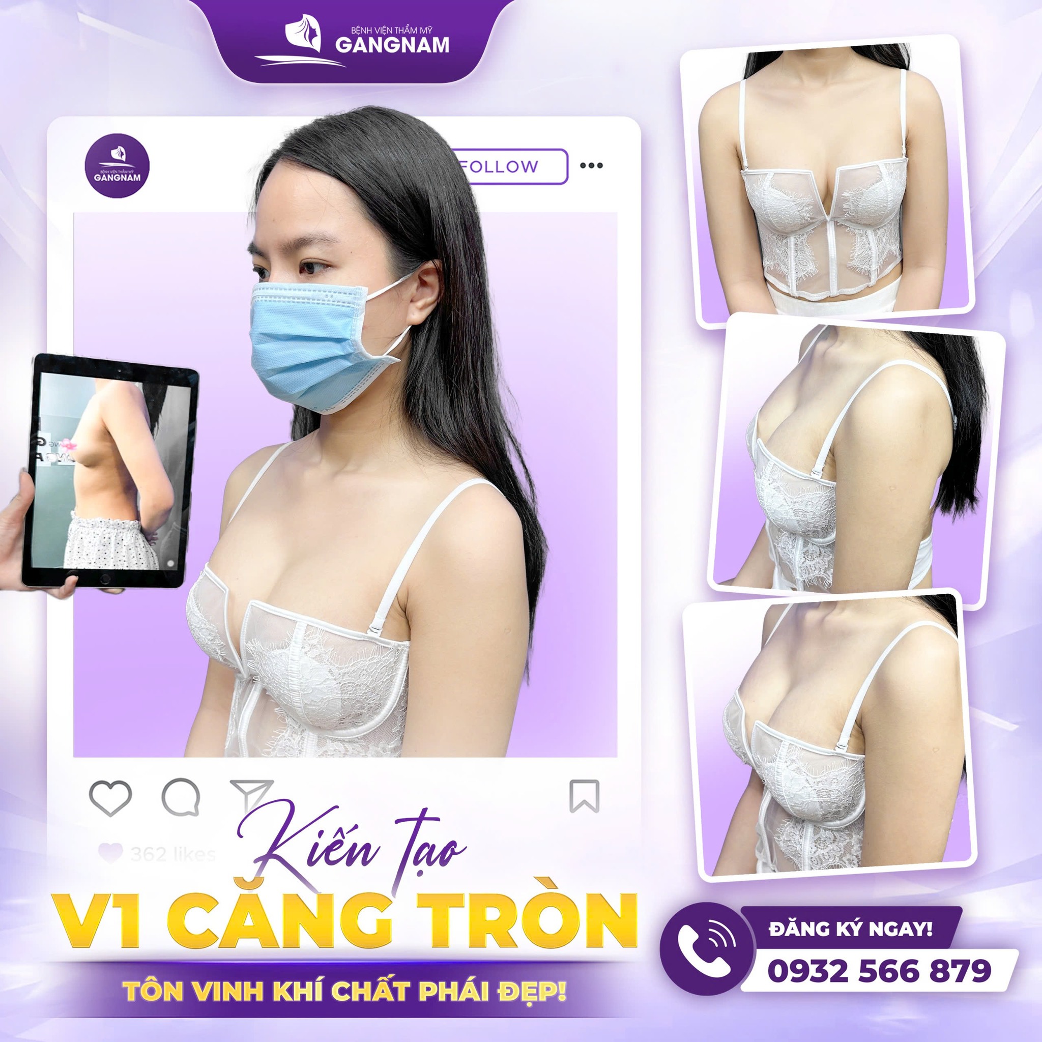 Nâng ngực túi độn silicon: Phương pháp thẩm mỹ vòng 1 an toàn và hiện đại 6 Nâng ngực túi độn silicon tại thẩm mỹ Gangnam – Sự lựa chọn hoàn hảo cho vòng 1 quyến rũ