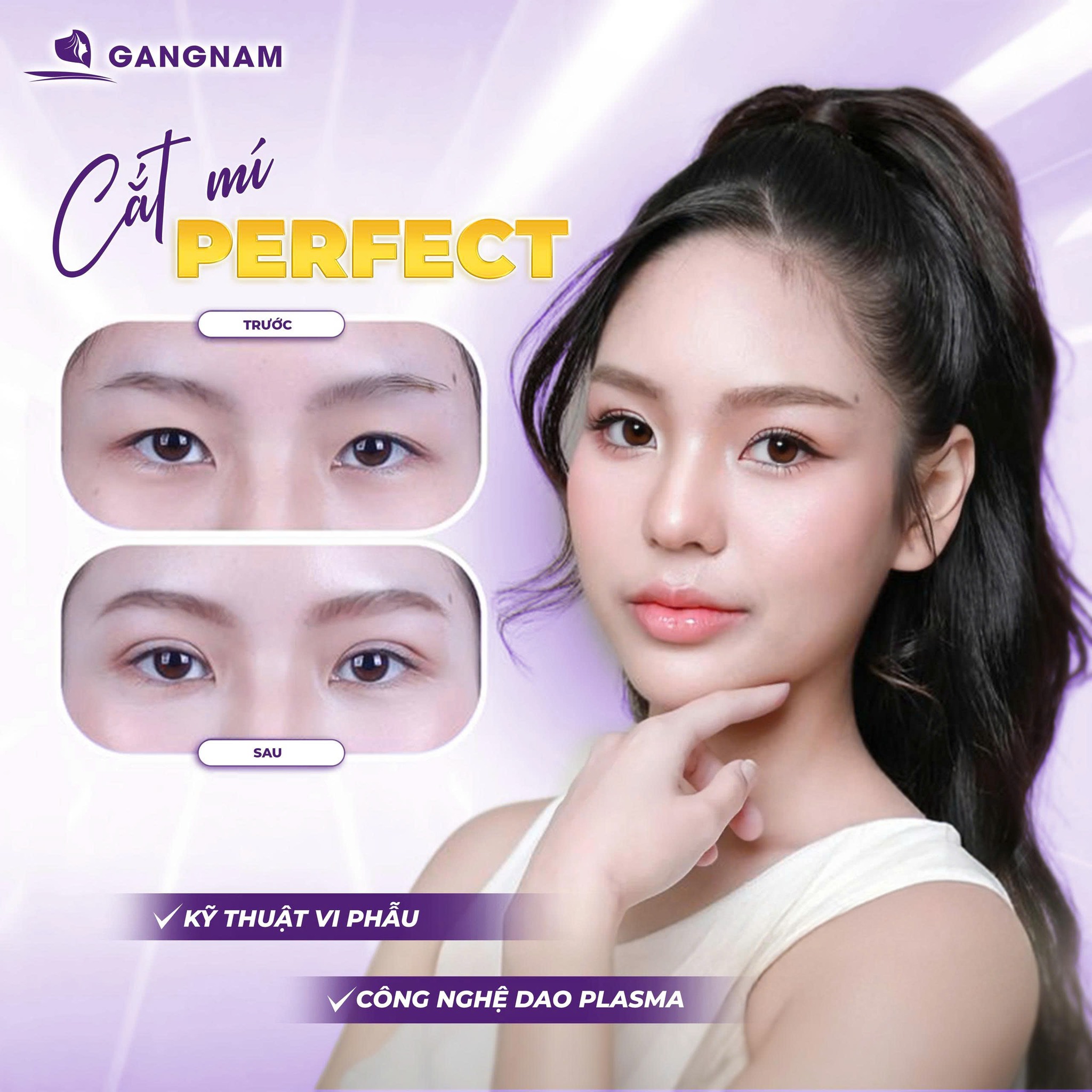 Nhấn mí perfect tự nhiên: Bí quyết sở hữu đôi mắt hai mí cuốn hút 4 Nhấn mí perfect tự nhiên là gì và cơ chế hoạt động như thế nào?
