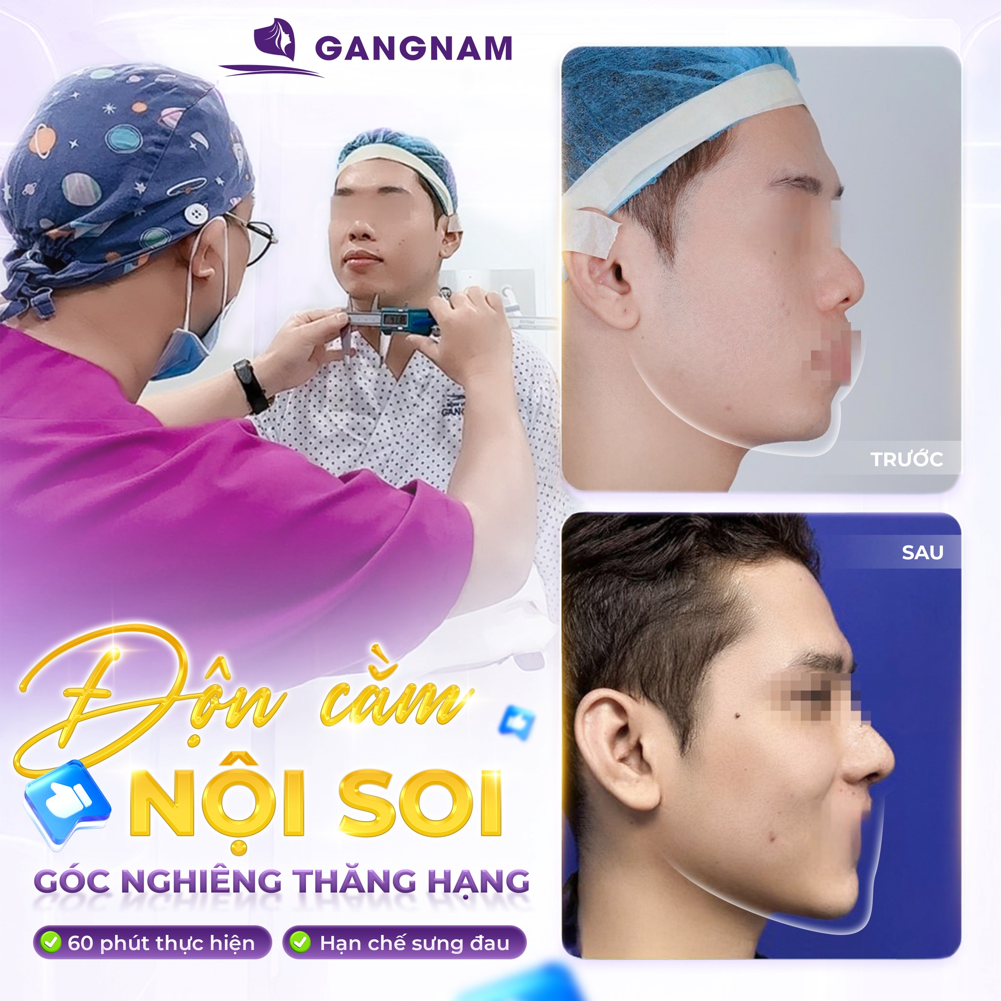 Độn cằm nội soi: Giải pháp thẩm mỹ hiện đại cho gương mặt V-line hoàn hảo 5 Quy trình độn cằm nội soi chuẩn y khoa hiện đại