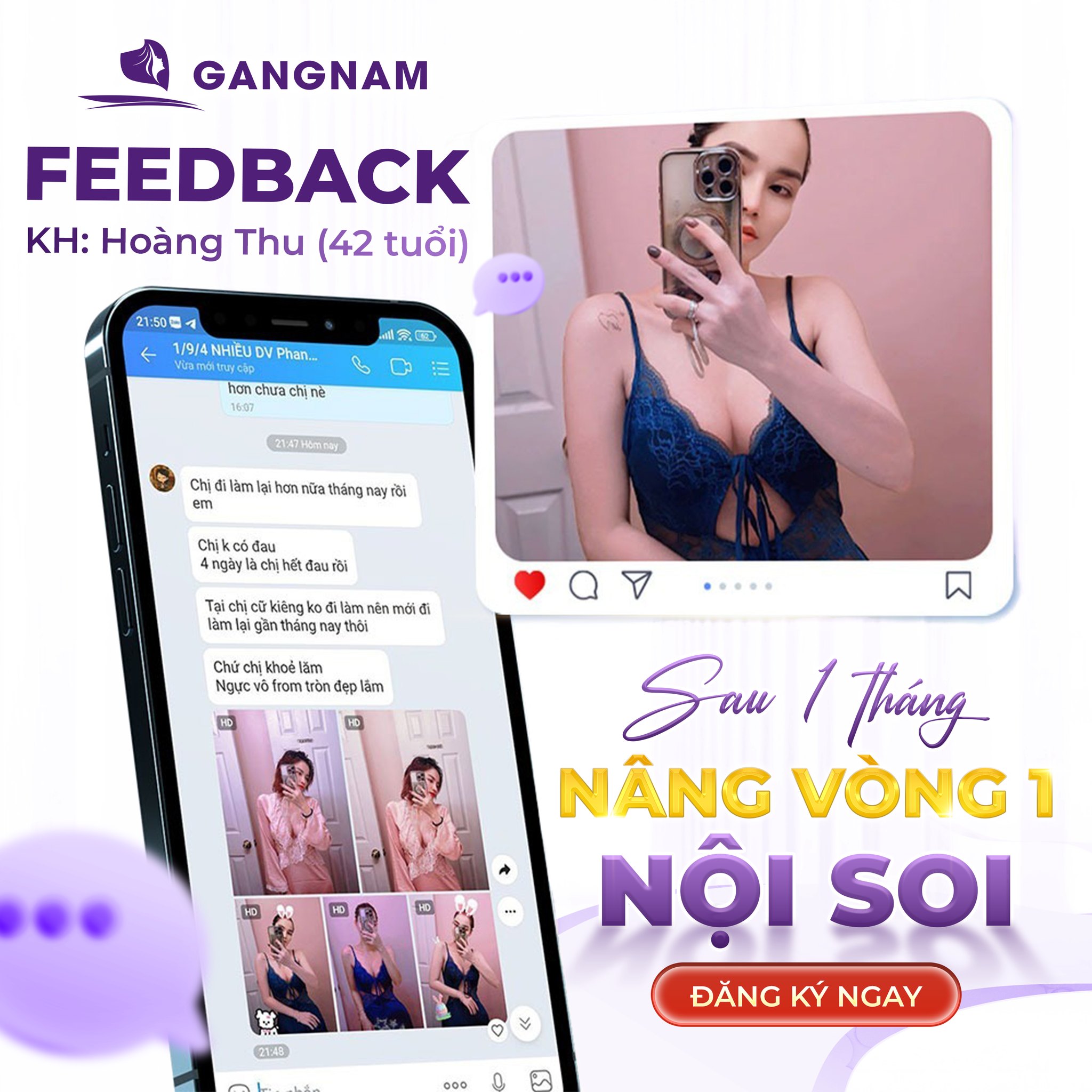 Nâng vòng 1 chuẩn size: Bí quyết sở hữu bộ ngực hài hòa và tự nhiên 6 Thẩm mỹ Gangnam – Địa chỉ nâng vòng 1 chuẩn size theo tỷ lệ cơ thể