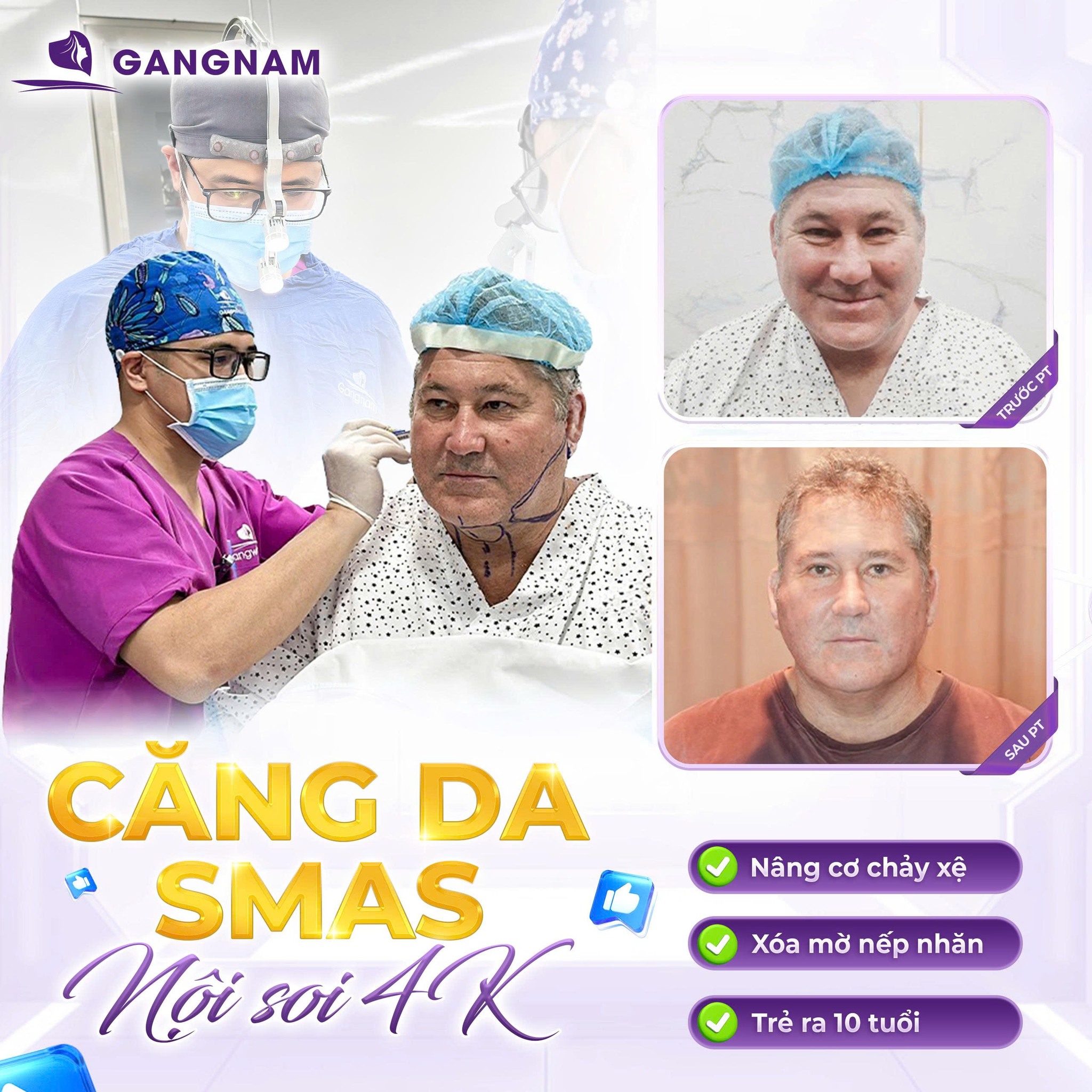 Căng Da Mặt SMAS Nội Soi: Giải Pháp Trẻ Hóa Toàn Diện, Hiệu Quả 6 Căng Da Mặt SMAS Nội Soi Tại Thẩm Mỹ Gangnam