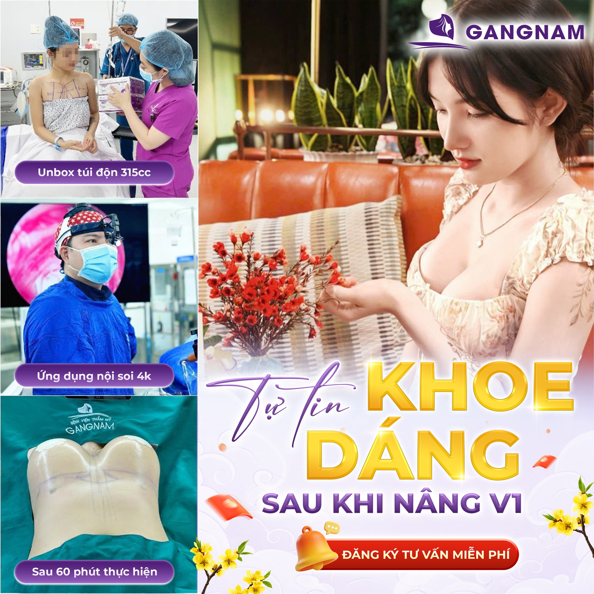 Nâng cấp vòng 1: Hành trình sở hữu bầu ngực tự nhiên, hài hòa 4 Các phương pháp nâng cấp vòng 1 phổ biến hiện nay