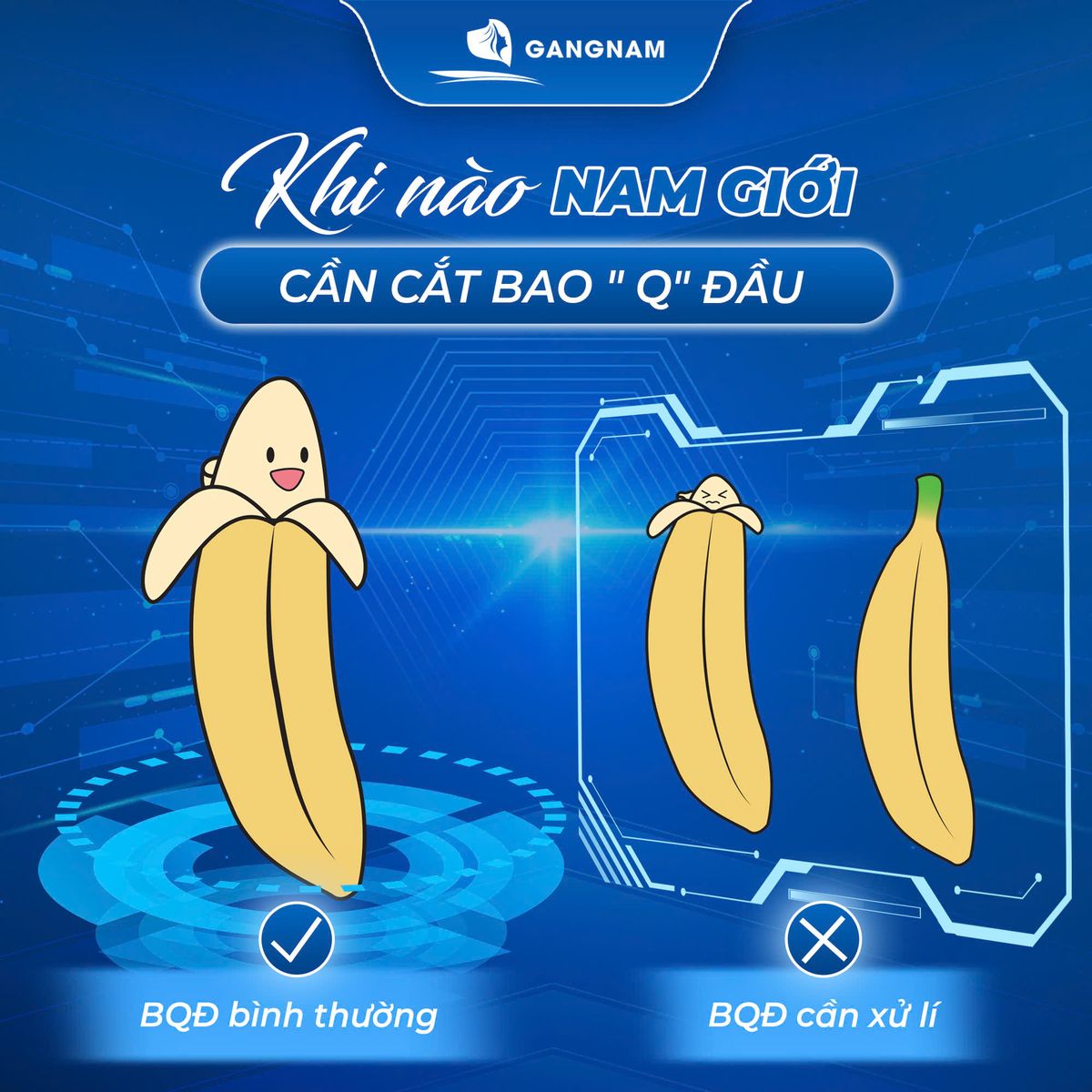 Cắt Bao Quy Đầu Thẩm Mỹ : Giải Pháp Hiện Đại Nâng Tầm Sức Khỏe Nam Giới 4 Tại sao nên chọn cắt bao quy đầu thẩm mỹ thay vì phương pháp truyền thống?