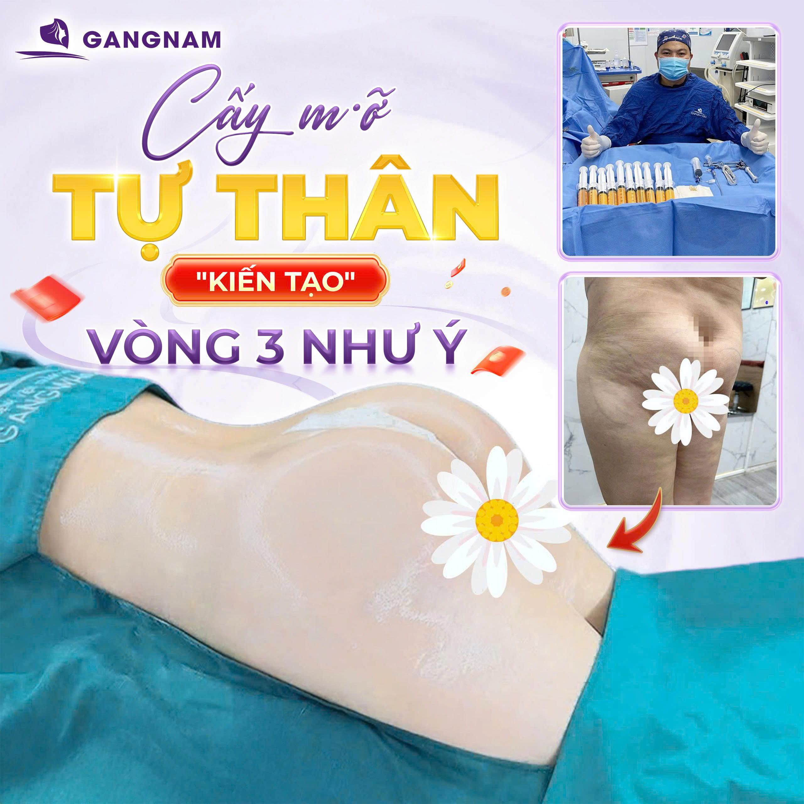 Cấy mỡ mông – Bí quyết sở hữu vòng 3 căng tròn tự nhiên 6 Thẩm mỹ Gangnam – Chuẩn mực làm đẹp an toàn và tinh tế