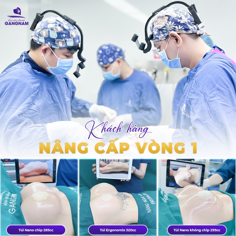 Tìm hiểu nâng ngực đặt túi độn silicon chuẩn y khoa 4 Nâng ngực đặt túi độn silicon là gì?