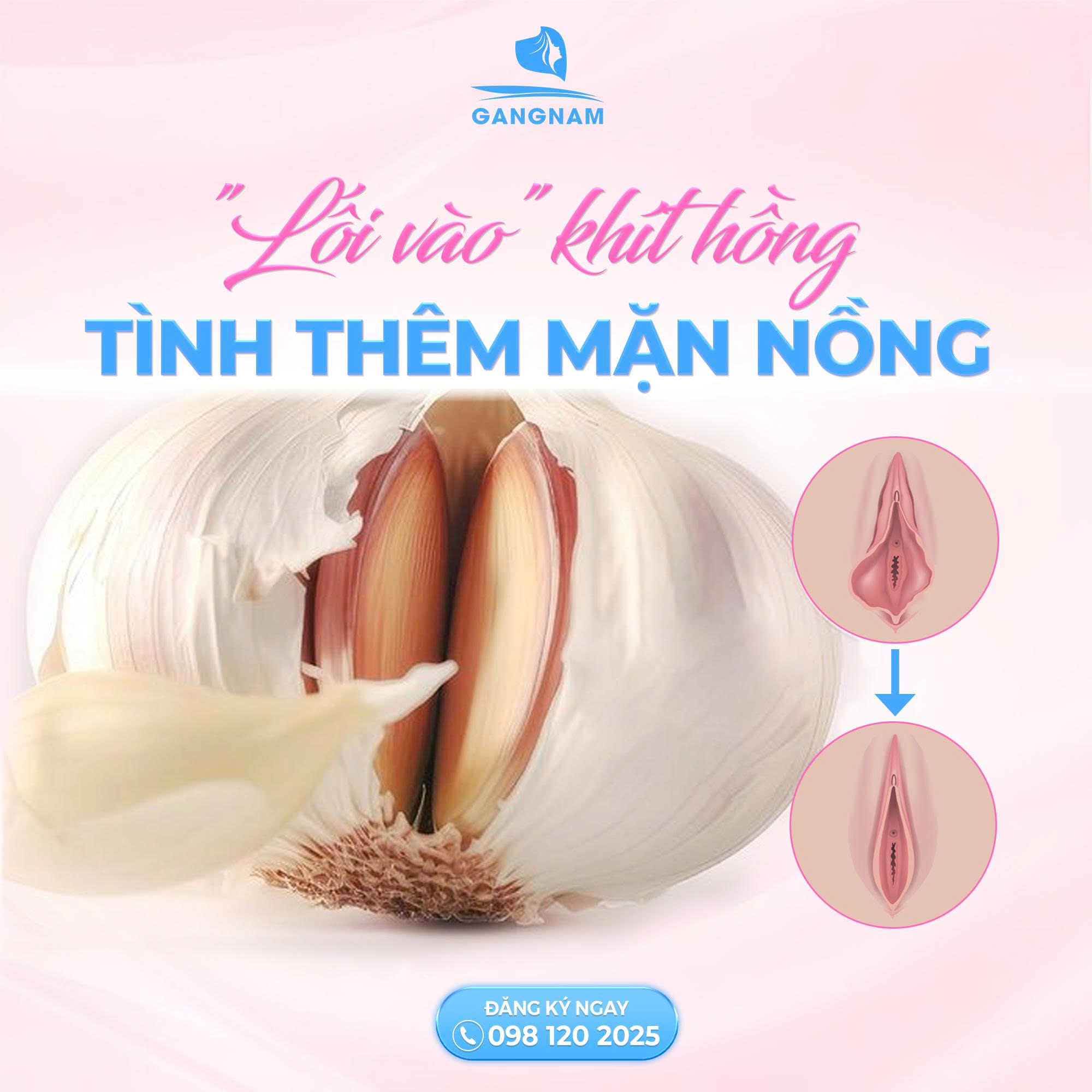 Se khít tầng sinh môn: Giải pháp phục hồi vùng kín toàn diện cho phụ nữ 6 Thẩm mỹ Gangnam – Địa chỉ se khít tầng sinh môn uy tín, chuẩn y khoa